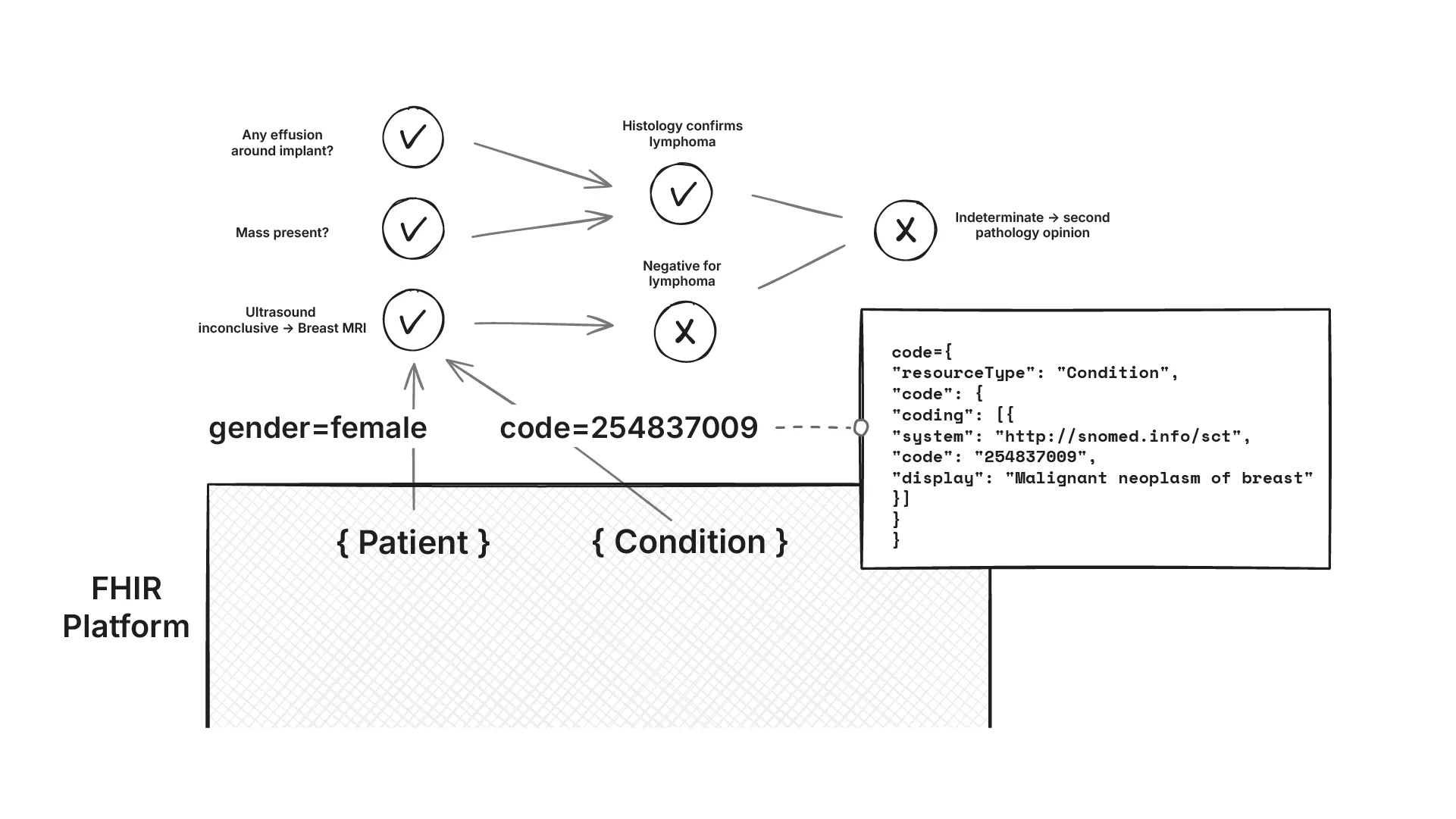 convert NCCN guidance into computable CDS rules